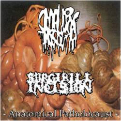 Surgikill Incision : Anatomical Patholocaust